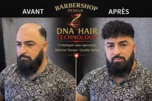 Barber Shop Peseux(Prothèse Capillaire )