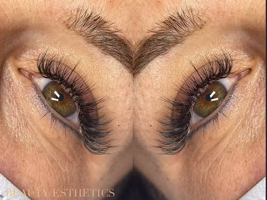 Esthétique de la beauté