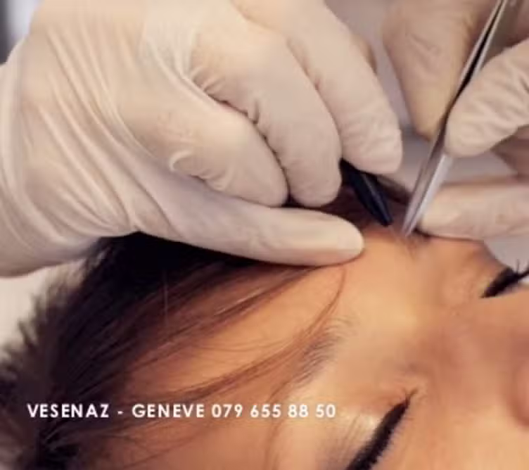 D-FINITIV – Epilation définitive électrique électrolyse électroépilation Genève